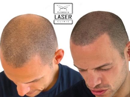 SMP Plymouth In Devon