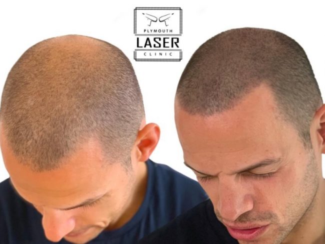 SMP Plymouth In Devon